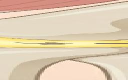 身体に重要な「脂肪」もあります。膝の痛みと関連する「膝蓋下脂肪体」について