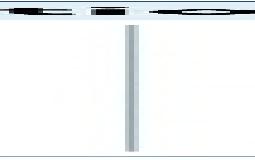 坐骨神経痛？その痺れ、痛み、骨盤の歪みが原因かも？