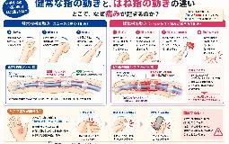 指の曲げ伸ばしでひっかかりが起きる…「ばね指」も整骨院にお任せください！