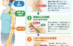 手の痺れ、痛み…その原因はいろいろあります！専門家の見極めが重要！